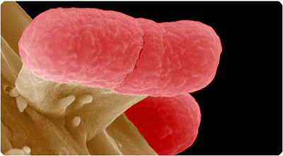 EHEC-bakterien.  NB! Flere lengre ned på siden i originalen. Disse er her i kronologisk rekkefølge (topp til bunn):