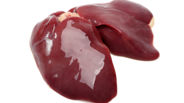 Kreft i leveren (Hepatocellulær cancer)