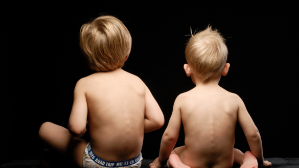 Autisme (autistisk syndrom)