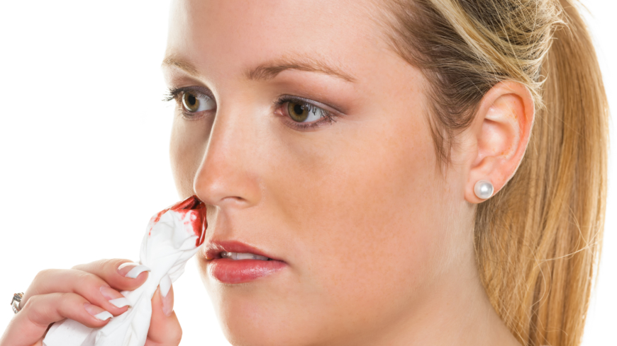 Neseblod oppstår når blodkarene i neseskilleveggen brister