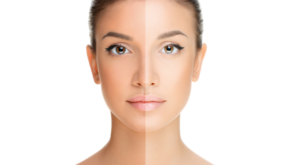 Borderline (borderline)