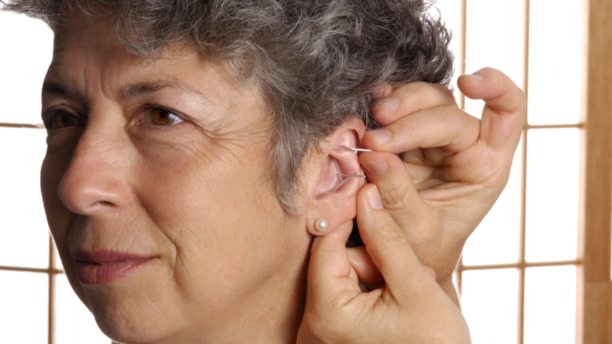 Døvhet beror på at noe har skjedd med hårcellene i det indre øret (flimmerhårene i det indre øret)