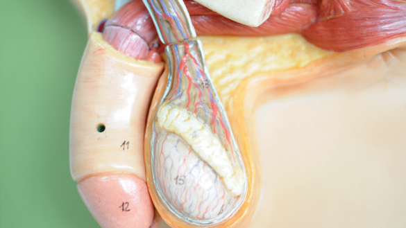 Klinefelter syndrom